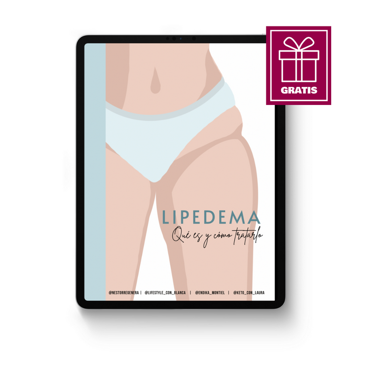 Lipedema: Qué es y cómo tratarlo - Ebook gratis